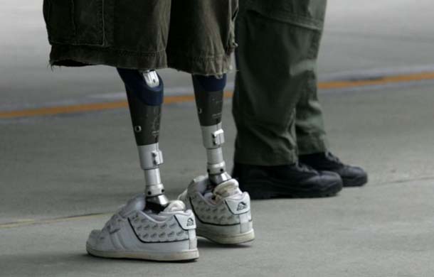 War amputees