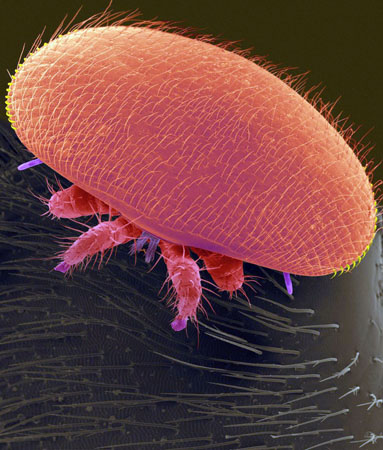 The varroa mite