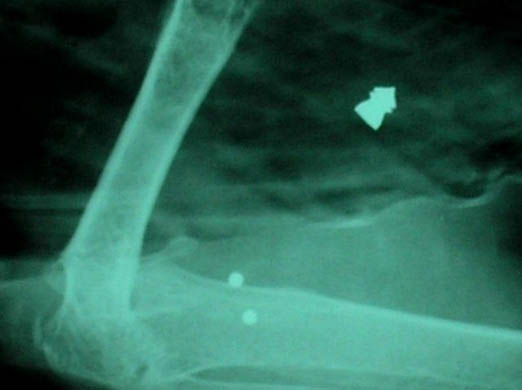 An x-ray of a swan, who has been severly injured