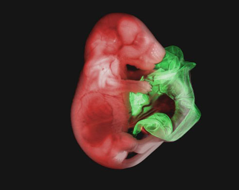 Tissues of a mouse embryo labelled with a green fluorescent protein and a red fluorescent protein