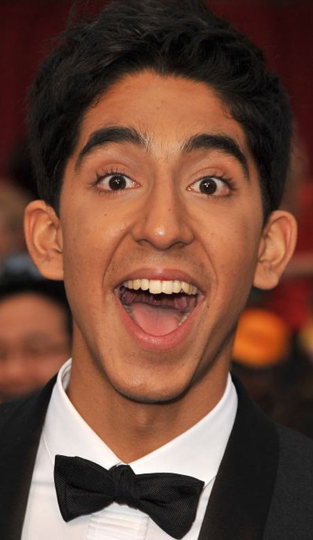 Dev Patel