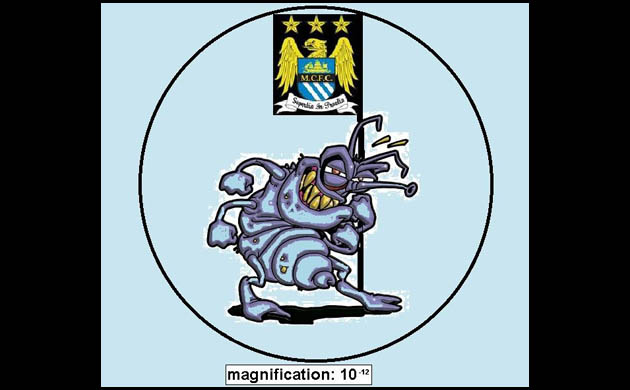 Manchester United's mystery virus