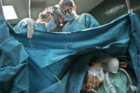 Doctors perform heart surgery on Allison Molina, 7