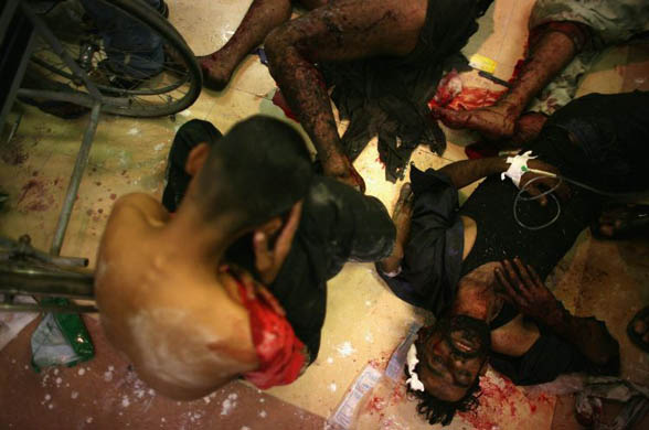 Injured men lie on the floor of a hospital