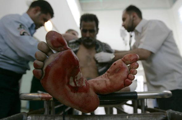 wounded man Baghdad