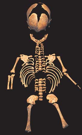 Skeletons Wellcome Collection