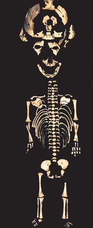 Skeletons Wellcome Collection