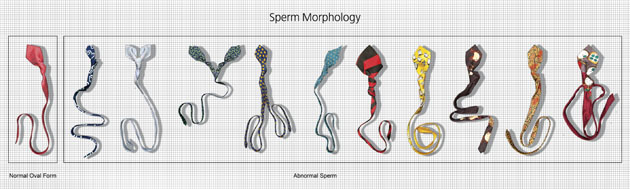 Sperm Morphology