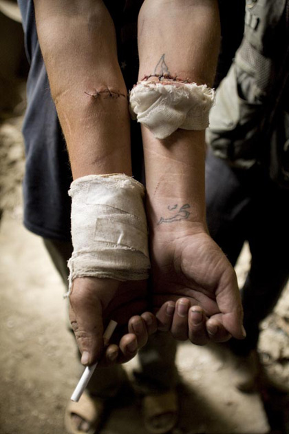 Heroin Addicts in Afghanistan