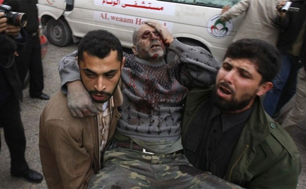 Palestinians rush a man to the hospital after he was wounded in an Israeli air strike in Gaza City on December 27, 2008. At least 155 Palestinians were killed across the Gaza Strip today in massive Israeli air strikes on the Hamas-run enclave, Hamas radio reported. Israeli military spokesman Avi Benayahu told army radio the massive bombardment of Gaza was only just beginning. 