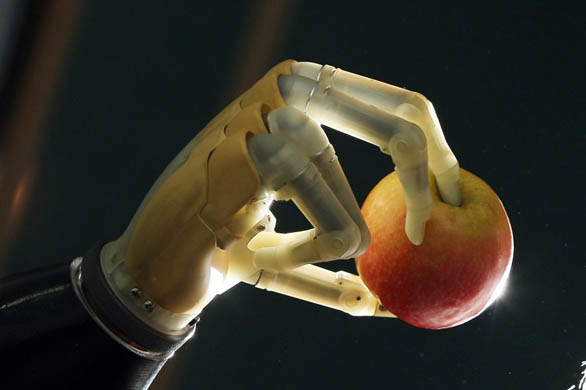 Donald McKillop with his new bionic hand