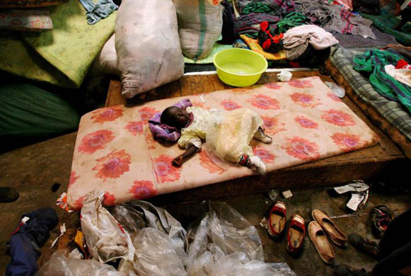 A baby suffering from malaria lies on a mattress at a camp for internally displaced people