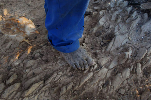 Shoeless man in Bulawayo 