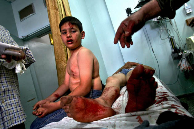 A young Palestinian boy injured by an Israeli air strike
