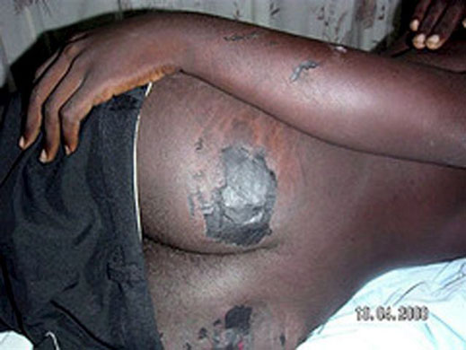 post-election violence in zimbabwe