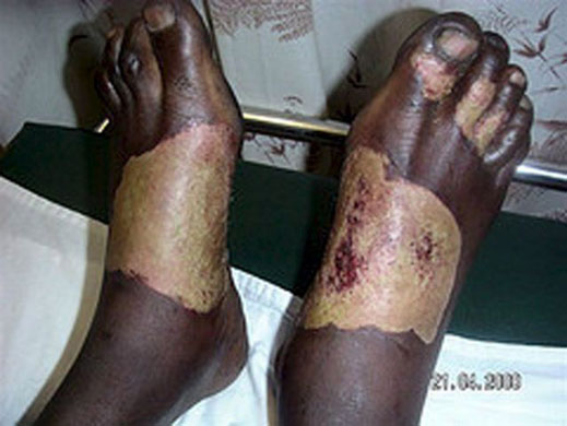 post-election violence in zimbabwe