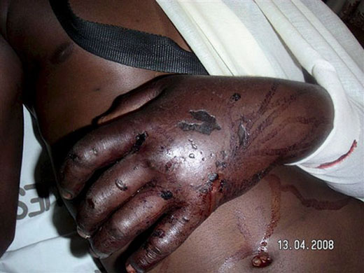 post-election violence in zimbabwe