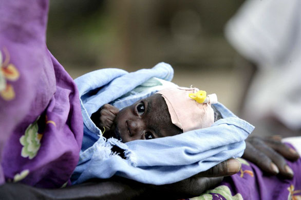 Kumi, Uganda: A baby suffering from malnutrition is cradled by her grandmother in the therapeutic feeding centre at a hospital