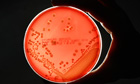 MRSA-bacteria-strain--003.jpg