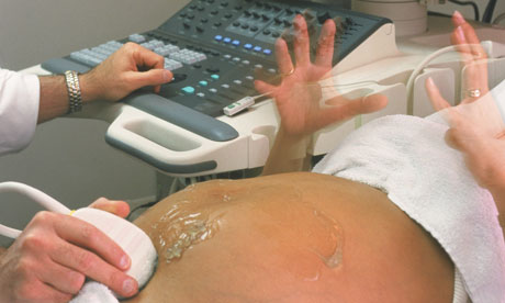 An expectant mother having an ultrasound scan