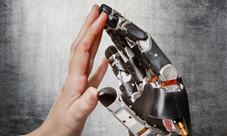 Robotic prosthetics