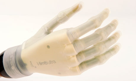 iLimb ultra prosthetic hand