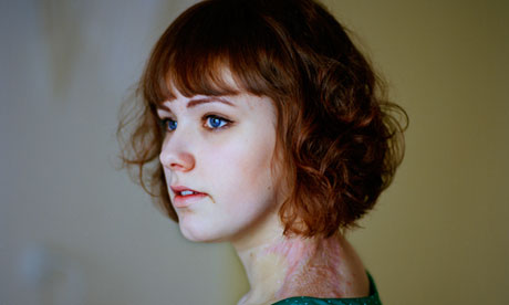 Andrea Gjestvang's One Day in History, L'Iris d'Or winner at the Sony world photography awards 2013