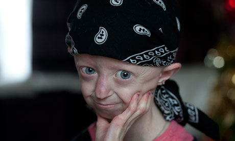 http://static.guim.co.uk/sys-images/Books/Pix/pictures/2011/12/20/1324397136860/12-year-old-Hayley-Okines-007.jpg