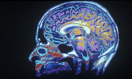 Brain Scan MRI