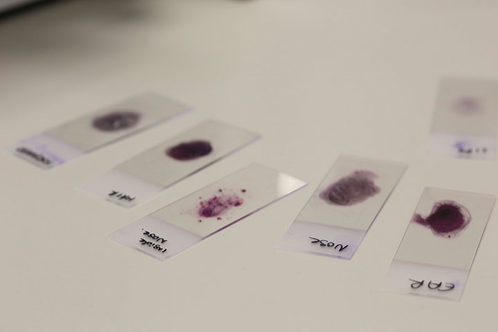 Broadvision: Broad Vision Stained bacteria microscope samples cultured from face 