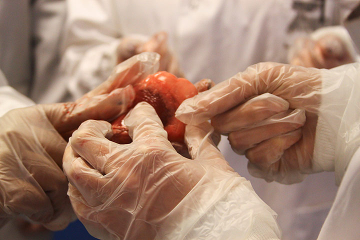 Broadvision: Broad Vision observing anatomy, heart dissection