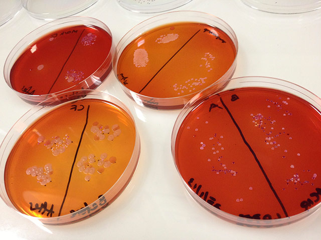 Broadvision: Broad Vision microbiology exercsise, thumbprints before and after cleaning