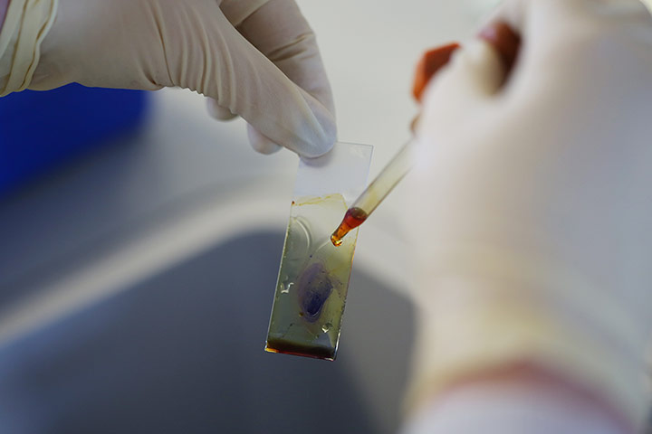 Broadvision: Broad vision dying bacteria