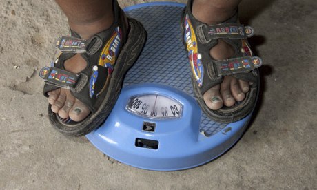 MDG : Obesity in India