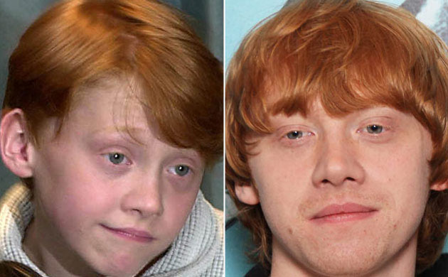 Harry Potter's Rupert Grint in 2000 and 2009