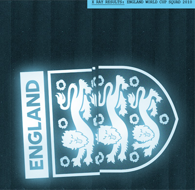 The Gallery: England's mounting injury concerns