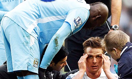 Balotelli Face Swell