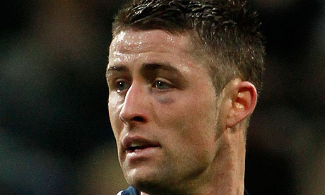 CHELSEA sickened by draw against Manchester United, says Gary Cahill