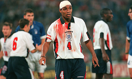 england football italy history paul ince cup captain injury head terry butcher clips guardian