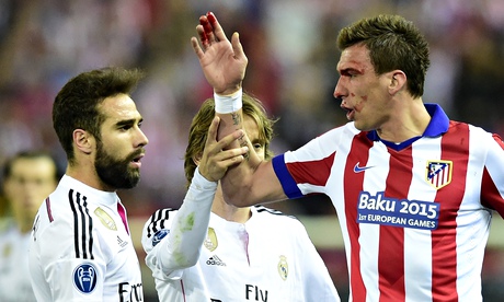 Mario Mandzukic