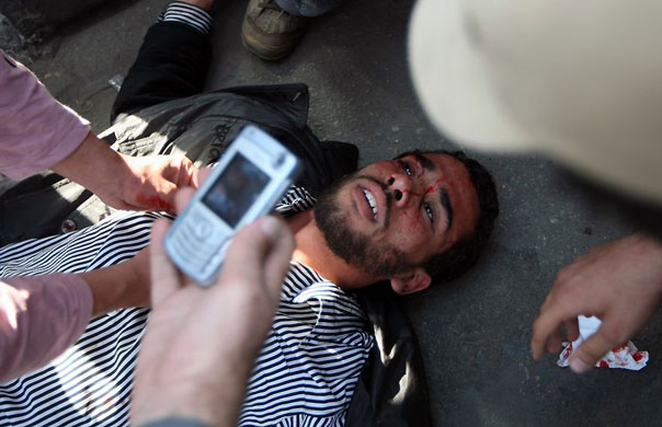 Gallery November 26 2008: Cairo, Egypt: A wounded protestor following clashes with riot police 