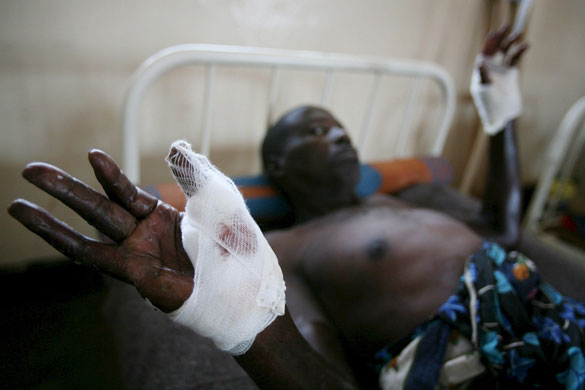Gallery 24 hours in pictures: War and Cholera epidemic civilian victims in Congo
