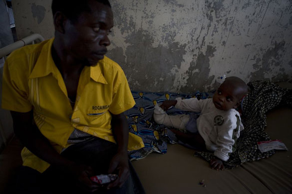 Gallery Congo conflict: Moise Mbarnsha who was injured in the fighting