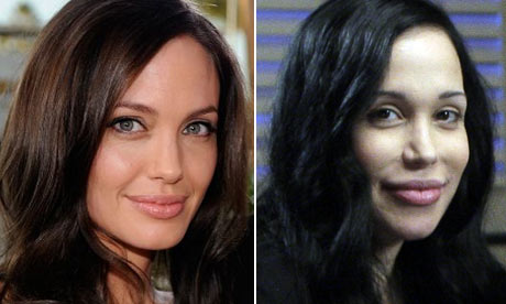 angelina jolie plastic surgery photos. Sobering times for Angelina