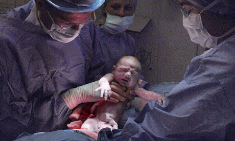 Terrified Of Tearing During Childbirth