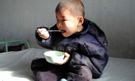 A Malnourished North Korean Boy