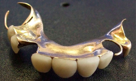 Interim Partial Denture. Churchill#39;s dentures and the