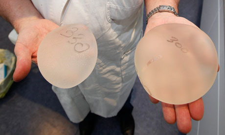 Plastic surgeon Denis Boucq displays silicone gel breast implants at his office in a clinic in Nice