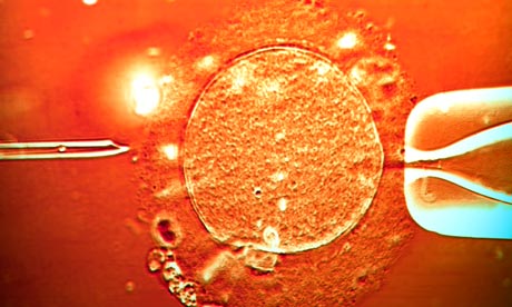 IVF treatment sperm