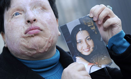 Ameneh Bahrami holds a photo showing herself before she was blinded with acid by Majid Movahedi.